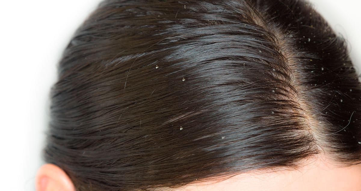 ознаки лупи